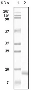 alpha Synuclein (SNCA) Mouse Monoclonal Antibody [Clone ID: 2B2D1] - image 1