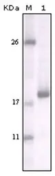 DDR2 Mouse Monoclonal Antibody [Clone ID: 3B11E4] - image 1