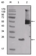 SRC Mouse Monoclonal Antibody [Clone ID: 4F1E8] - image 1