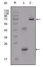 IGFBP2 Mouse Monoclonal Antibody [Clone ID: 1F6F6] - image 1