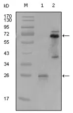 SLC22A1 Mouse Monoclonal Antibody [Clone ID: 8C1A3] - image 1