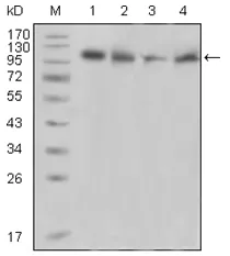 PYK2 (PTK2B) Mouse Monoclonal Antibody [Clone ID: 5E2D5] - image 1