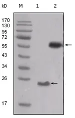 SRC Mouse Monoclonal Antibody [Clone ID: 5D10C4] - image 1