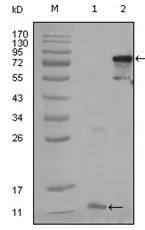 PPAR gamma (PPARG) Mouse Monoclonal Antibody [Clone ID: 3A4A9] - image 1