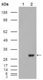 Carbonic Anhydrase I (CA1) Mouse Monoclonal Antibody [Clone ID: 9D6D7] - image 1