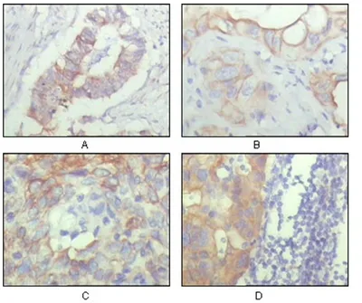 CD166 (ALCAM) Mouse Monoclonal Antibody [Clone ID: 10F1G12] - image 1