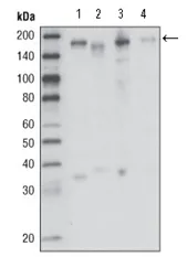 RON (MST1R) Mouse Monoclonal Antibody [Clone ID: 1B5A9] - image 1