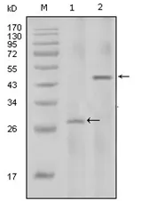 IL2 Mouse Monoclonal Antibody [Clone ID: 8D5] - image 1