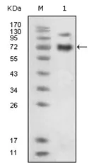 Eph receptor B4 (EPHB4) Mouse Monoclonal Antibody [Clone ID: 5B5] - image 1