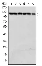 PARP1 Mouse Monoclonal Antibody [Clone ID: 7A10] - image 1