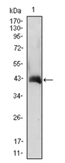GM CSF (CSF2) Mouse Monoclonal Antibody [Clone ID: 3D3] - image 1