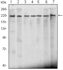 CHD3 Mouse Monoclonal Antibody [Clone ID: 2G4] - image 1