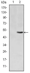 MTHFR Mouse Monoclonal Antibody [Clone ID: 5D3] - image 1