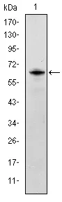 MSH6 Mouse Monoclonal Antibody [Clone ID: 3E1] - image 1