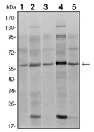 SMAD4 Mouse Monoclonal Antibody [Clone ID: 4G1C6] - image 1
