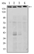 RICTOR Mouse Monoclonal Antibody [Clone ID: 4H5] - image 1