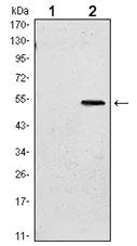 SUZ12 Mouse Monoclonal Antibody [Clone ID: 3D10] - image 1