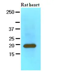 Myosin Light Chain 2 (MYL2) (1-166) Mouse Monoclonal Antibody [Clone ID: AT3B2] - image 1