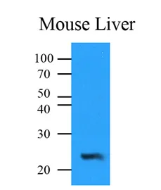 NQO2 Mouse Monoclonal Antibody [Clone ID: AT1E3] - image 1