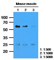 CASQ2 Mouse Monoclonal Antibody [Clone ID: AT4E10] - image 1