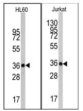 beta Actin (ACTB) Mouse Monoclonal Antibody [Clone ID: 4E8H3] - image 1