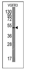 FLT4 Mouse Monoclonal Antibody [Clone ID: 44CT92.4.4] - image 1
