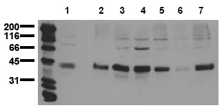 Aurora A (AURKA) (C-term) (incl. pos. control) Mouse Monoclonal Antibody [Clone ID: 5F11] - image 1