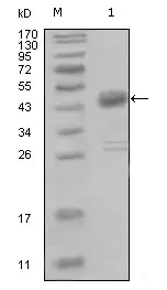 MCK10 (DDR1) Mouse Monoclonal Antibody [Clone ID: 2G4E12] - image 1