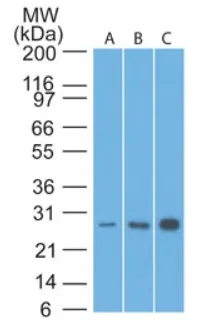 BCL2 (41-54) Mouse Monoclonal Antibody [Clone ID: 8C8] - image 1