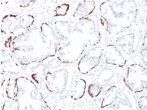 basic Cytokeratin Mouse Monoclonal Antibody [Clone ID: 34betaE12] - image 1