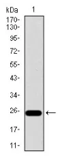 Integrin beta 4 (ITGB4) (1619-1822) Mouse Monoclonal Antibody [Clone ID: 10B10D5] - image 1
