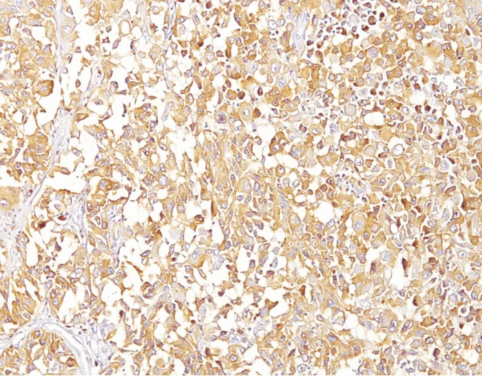 Melanoma gp100 (PMEL) (PMEL17 / SILV) Mouse Monoclonal Antibody [Clone ID: HMB45] - image 1
