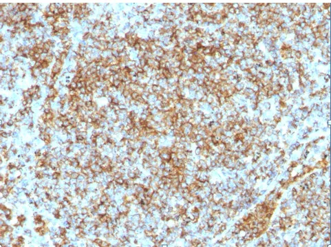 CD45 (PTPRC) (CD45RB) Mouse Monoclonal Antibody [Clone ID: SPM569] - image 1