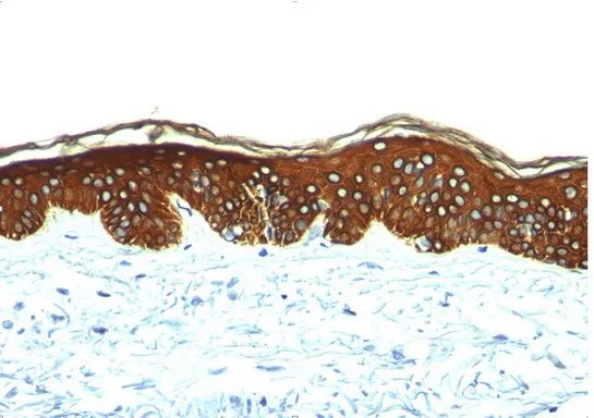 basic Cytokeratin Mouse Monoclonal Antibody [Clone ID: SPM116] - image 1