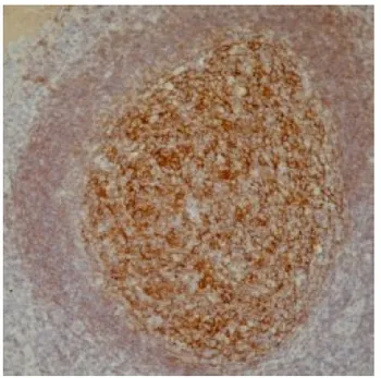 CD21 (CR2) Mouse Monoclonal Antibody [Clone ID: 2G9] - image 1