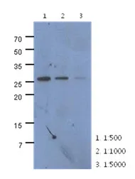 CMBL Mouse Monoclonal Antibody [Clone ID: AT2B11] - image 1