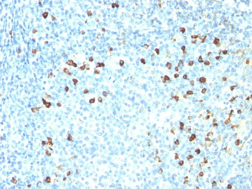 Human Kappa Light Chain Mouse Monoclonal Antibody [Clone ID: SPM558] - image 1