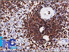 CD45 (PTPRC) (CD45RA) Mouse Monoclonal Antibody [Clone ID: SPM568] - image 1