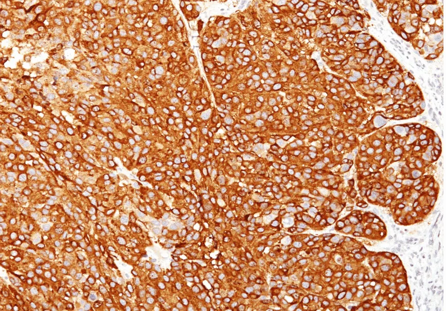 MelanA (MLANA) Mouse Monoclonal Antibody [Clone ID: M2-7C10 + M2-9E3 + T311 + HMB45] - image 1