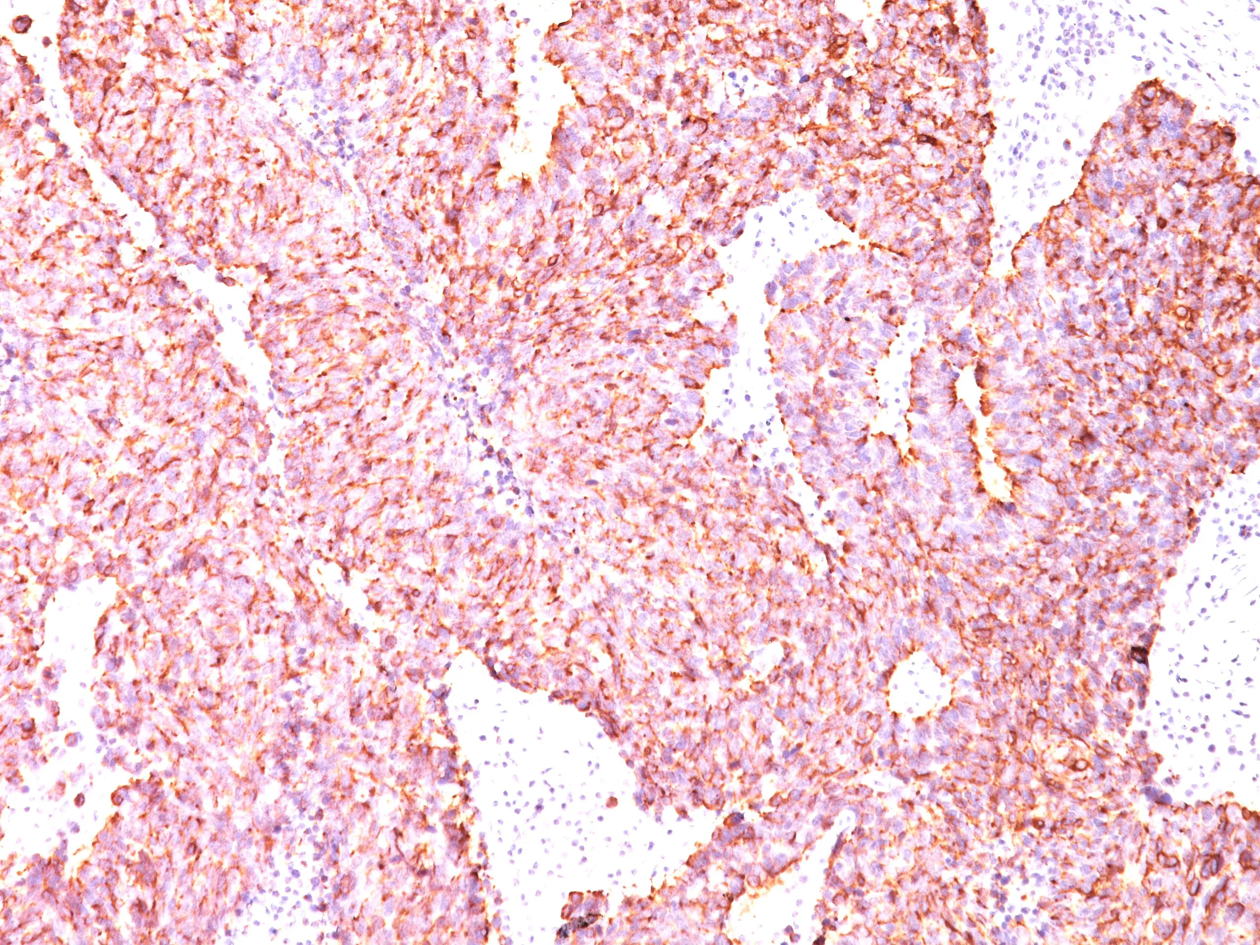 Chromogranin A (CHGA) Mouse Monoclonal Antibody [Clone ID: SPM585] - image 1