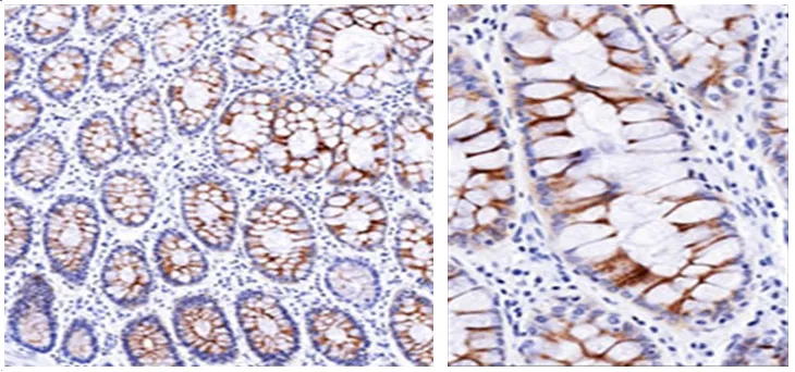 ECM1 Mouse Monoclonal Antibody [Clone ID: SPM217] - image 1