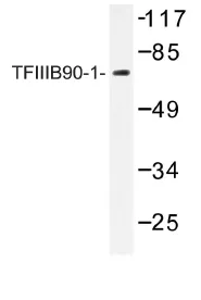 BRF1 Rabbit Polyclonal Antibody - image 1