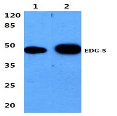 S1PR2 Rabbit Polyclonal Antibody - image 1