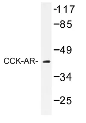 CCKAR Rabbit Polyclonal Antibody - image 1