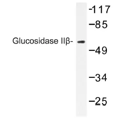 Glucosidase 2 subunit beta (PRKCSH) Rabbit Polyclonal Antibody - image 1