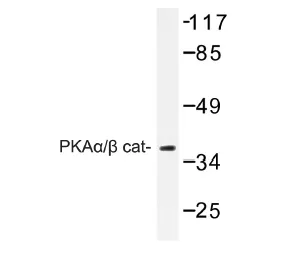 PRKACA Rabbit Polyclonal Antibody - image 1