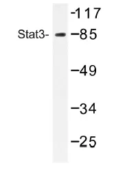 STAT3 Rabbit Polyclonal Antibody - image 1