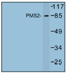 PMS2 Rabbit Polyclonal Antibody - image 1