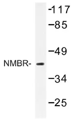 NMBR Rabbit Polyclonal Antibody - image 1