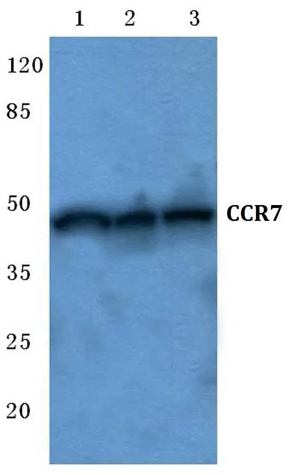 CCR7 Rabbit Polyclonal Antibody - image 1